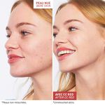 CC Red Correct - Anti redness cream cc red correct   anti redness cream